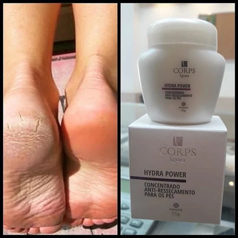 Image of HIDRA POWER CREMA HIDRATANTE PARA PIES RESECOS / Envio Gratis