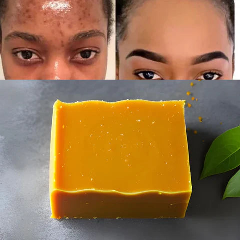 Image of JABON DE CURCUMA ORGANICO