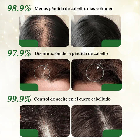 Image of SHAMPOO ACEITE DE BATANA Y ROMERO - ENVIO GRATIS